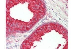 Human Prostate: Formalin-Fixed, Paraffin-Embedded (FFPE) (NEDD4-2 Antikörper  (AA 225-275))
