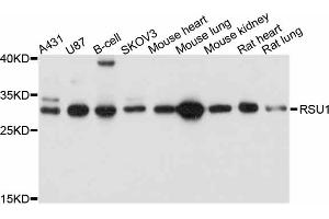 Western blot analysis of extracts of various cell lines, using RSU1 antibody (ABIN4905071) at 1:1000 dilution. (RSU1 Antikörper)