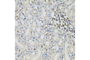 Immunohistochemistry (IHC) image for anti-Proteasome (Prosome, Macropain) 26S Subunit, ATPase, 3 (PSMC3) (AA 1-180) antibody (ABIN3022705)