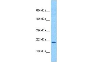 Western Blotting (WB) image for anti-Transcription Factor 21 (TCF21) (N-Term) antibody (ABIN2777930)