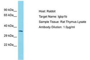 Image no. 1 for anti-Immunoglobulin (CD79A) Binding Protein 1b (IGBP1B) (AA 151-200) antibody (ABIN6750466) (IGBP1B Antikörper  (AA 151-200))