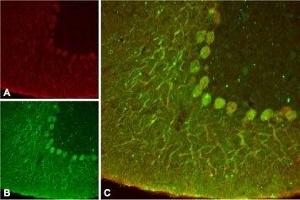 Expression of KCNK4 in rat cerebellumImmunohistochemical staining of rat cerebellum using Anti-KCNK4 (TRAAK) Antibody (ABIN7043454, ABIN7045004 and ABIN7045005 ). (Potassium Channel, Subfamily K, Member 4 (KCNK4) Peptid)