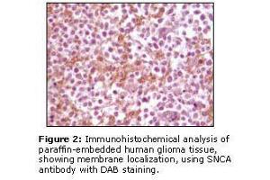 Image no. 1 for anti-Synuclein, alpha (SNCA) antibody (ABIN232104) (SNCA Antikörper)