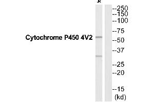 Western blot analysis of extracts from Jurkat cells, using CYP4V2 antibody. (CYP4V2 Antikörper  (Internal Region))