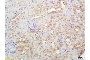 Formalin-fixed and paraffin embedded rat kidney labeled with Rabbit Anti PLEKHM2/SKIP Polyclonal Antibody, Unconjugated (ABIN872446) at 1:200 followed by conjugation to the secondary antibody and DAB staining (PLEKHM2 Antikörper  (AA 688-750))