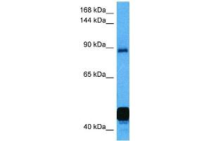 Host:  Mouse  Target Name:  NFATC2  Sample Tissue:  Mouse Kidney  Antibody Dilution:  1ug/ml (NFAT1 Antikörper  (C-Term))