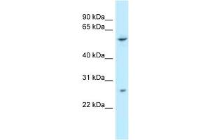 WB Suggested Anti-TTC39B Antibody Titration: 1. (TTC39B Antikörper  (C-Term))