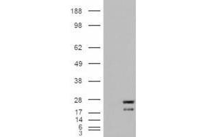Western Blotting (WB) image for anti-GTPase NRas (NRAS) antibody (ABIN5872672) (GTPase NRas Antikörper)
