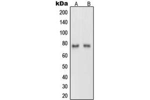 Western blot analysis of Netrin 1 expression in rat brain (A), PC12 (B) whole cell lysates. (Netrin 1 Antikörper  (C-Term))