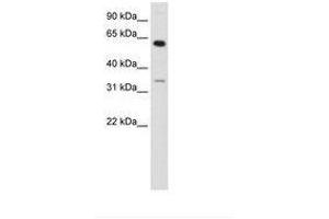 Image no. 1 for anti-Zinc Finger Protein 609 (ZNF609) (AA 71-120) antibody (ABIN202985) (ZNF609 Antikörper  (AA 71-120))