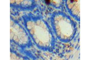 Used in DAB staining on fromalin fixed paraffin-embedded rectum tissue (NFKBIE Antikörper  (AA 115-350))