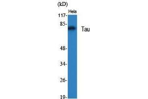 Western Blot (WB) analysis of specific cells using Tau Polyclonal Antibody. (tau Antikörper  (Ser855))