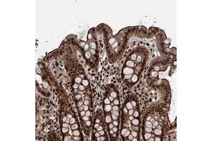 Immunohistochemical staining of human colon with ANKRD49 polyclonal antibody  shows strong nuclear, cytoplasmic and membranous positivity in glandular cells. (ANKRD49 Antikörper)