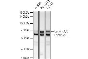 Western blot analysis of extracts of various cell lines, using [KO Validated] Lamin A/C Rabbit mAb antibody (ABIN7268177) at 1:500000 dilution. (Lamin A/C Antikörper)