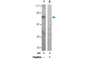 Western blot analysis of extracts from HeLa cells, treated with UV (5 mins), using RAF1 polyclonal antibody . (RAF1 Antikörper)