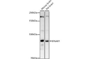 Western blot analysis of extracts of various cell lines, using IFN antibody (ABIN3015552, ABIN3015553, ABIN1680393 and ABIN6218813) at 1:1000 dilution. (IFNAR1 Antikörper  (AA 28-290))