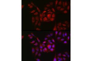 Immunofluorescence analysis of U2OS cells using RB Rabbit pAb (ABIN7269795) at dilution of 1:150 (40x lens). (RAB11B Antikörper  (AA 130-215))