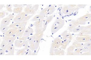 Detection of TNNT2 in Porcine Cardiac Muscle Tissue using Monoclonal Antibody to Troponin T Type 2, Cardiac (TNNT2) (Cardiac Troponin T2 Antikörper  (AA 1-295))