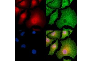 ABIN6262437 and ABIN6278874 staining  cells by IF/ICC. (CARD18 Antikörper  (C-Term))