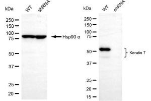Western blotting analysis using keratin 7 antibody (ABIN7799185).