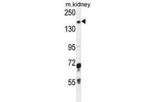 IGSF1 Antibody (C-term) western blot analysis in mouse kidney tissue lysates (35µg/lane).