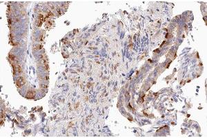 ABIN6266898 at 1/100 staining human Fallopian tube tissue sections by IHC-P. (UBXN11 Antikörper  (Internal Region))