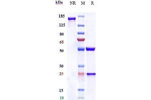 Anti-CEACAM5 / CEA / CD66e Reference Antibody (labetuzumab) on SDS-PAGE under reducing (R) condition. (Rekombinanter CEACAM5 (Labetuzumab Biosimilar) Antikörper)
