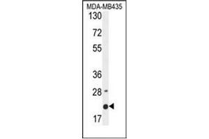 Western blot analysis of MS4A4A Antibody (N-term) in MDA-MB435 cell line lysates (35ug/lane).