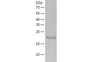 Western Blotting (WB) image for N-6 Adenine-Specific DNA Methyltransferase 1 (Putative) (N6AMT1) (AA 1-214) protein (His tag) (ABIN7124082) (N6AMT1 Protein (AA 1-214) (His tag))