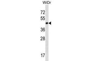 THAP11 Antibody (N-term) western blot analysis in WiDr cell line lysates (35 µg/lane).
