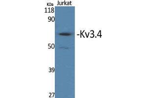 Western Blotting (WB) image for anti-Potassium Voltage-Gated Channel, Shaw-Related Subfamily, Member 4 (KCNC4) (Ser676) antibody (ABIN3185335)