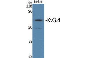 Western Blot (WB) analysis of specific cells using Kv3.