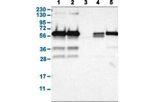 Western Blot analysis with HDAC2 polyclonal antibody . (HDAC2 Antikörper  (AA 415-488))