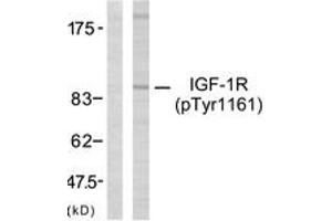 Western Blotting (WB) image for anti-Insulin-Like Growth Factor 1 Receptor (IGF1R) (AA 1131-1180), (pTyr1161) antibody (ABIN1531870)