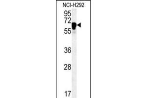 TTC26 Antibody (C-term) (ABIN651518 and ABIN2840274) western blot analysis in NCI- cell line lysates (35 μg/lane). (TTC26 Antikörper  (C-Term))