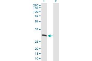 Western Blot analysis of MCART1 expression in transfected 293T cell line by MCART1 MaxPab polyclonal antibody. (MCART1 Antikörper  (AA 1-297))