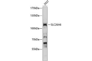 Western blot analysis of extracts of 293T cells, using SLC26 antibody (ABIN6129129, ABIN6147938, ABIN6147939 and ABIN6214535) at 1:1000 dilution. (SLC26A6 Antikörper  (AA 509-758))