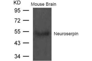 Western blot analysis of extract from Mouse brain tissue using Neuroserpin Antibody (Neuroserpin Antikörper)