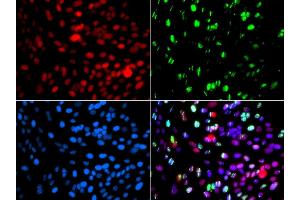 Immunofluorescence analysis of GFP-RNF168 transgenic U2OS cells using POLD3 antibody. (POLD3 Antikörper  (AA 197-466))