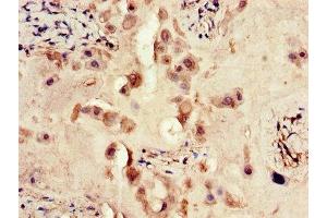 Immunohistochemistry of paraffin-embedded human placenta tissue using ABIN7167466 at dilution of 1:100 (ERBB4 Antikörper  (AA 1027-1204))