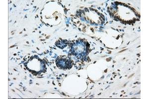 Immunohistochemical staining of paraffin-embedded prostate tissue using anti-ERCC1 mouse monoclonal antibody. (ERCC1 Antikörper)