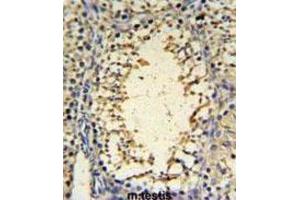 Immunohistochemistry (IHC) image for anti-IMP3, U3 Small Nucleolar Ribonucleoprotein (IMP3) antibody (ABIN3004369) (IMP3 Antikörper)