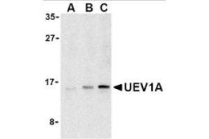 Image no. 1 for anti-Ubiquitin-Conjugating Enzyme E2 Variant 1 (UBE2V1) (C-Term) antibody (ABIN265158) (UBE2V1 Antikörper  (C-Term))