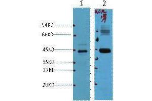 Western Blotting (WB) image for anti-alpha-Methylacyl-CoA Racemase (AMACR) antibody (ABIN3181117) (AMACR Antikörper)