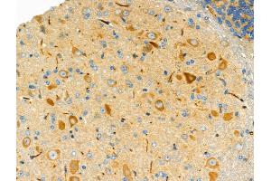 ABIN6258458 and ABIN6275750 at 1/100 staining Mouse brain tissue by IHC-P. (BRE Antikörper  (C-Term))
