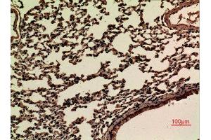 Immunohistochemistry (IHC) image for anti-Junctional Adhesion Molecule 2 (JAM2) (Internal Region) antibody (ABIN3187667)