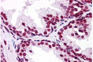Human Prostate: Formalin-Fixed, Paraffin-Embedded (FFPE) (UBA2 Antikörper  (C-Term))