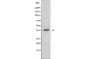 Western blot analysis of extracts from MCF-7 cells, using ABHD9 antibody. (ABHD9 Antikörper  (N-Term))