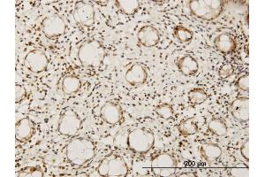Immunoperoxidase of monoclonal antibody to HEYL on formalin-fixed paraffin-embedded human colon.