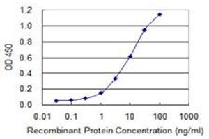Detection limit for recombinant GST tagged IRX6 is 0. (IRX6 Antikörper  (AA 337-446))